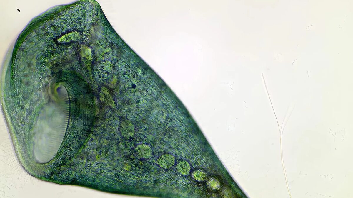 Sinh vật đơn bào Stentor coeruleus chứng minh rằng học hỏi có thể không cần dùng tới não