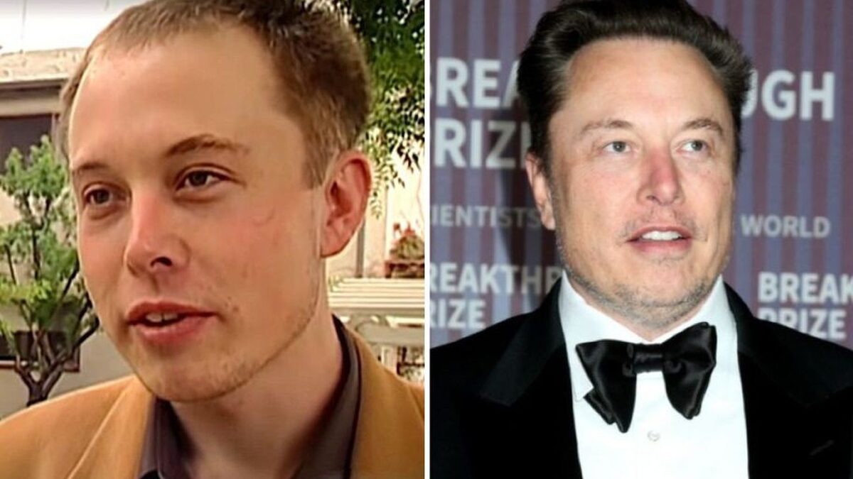 Bệnh hói đầu sắp ”tuyệt chủng” đến nơi: Huyết thanh từ thực vật giúp tóc dày lên 25% chỉ trong 56 ngày