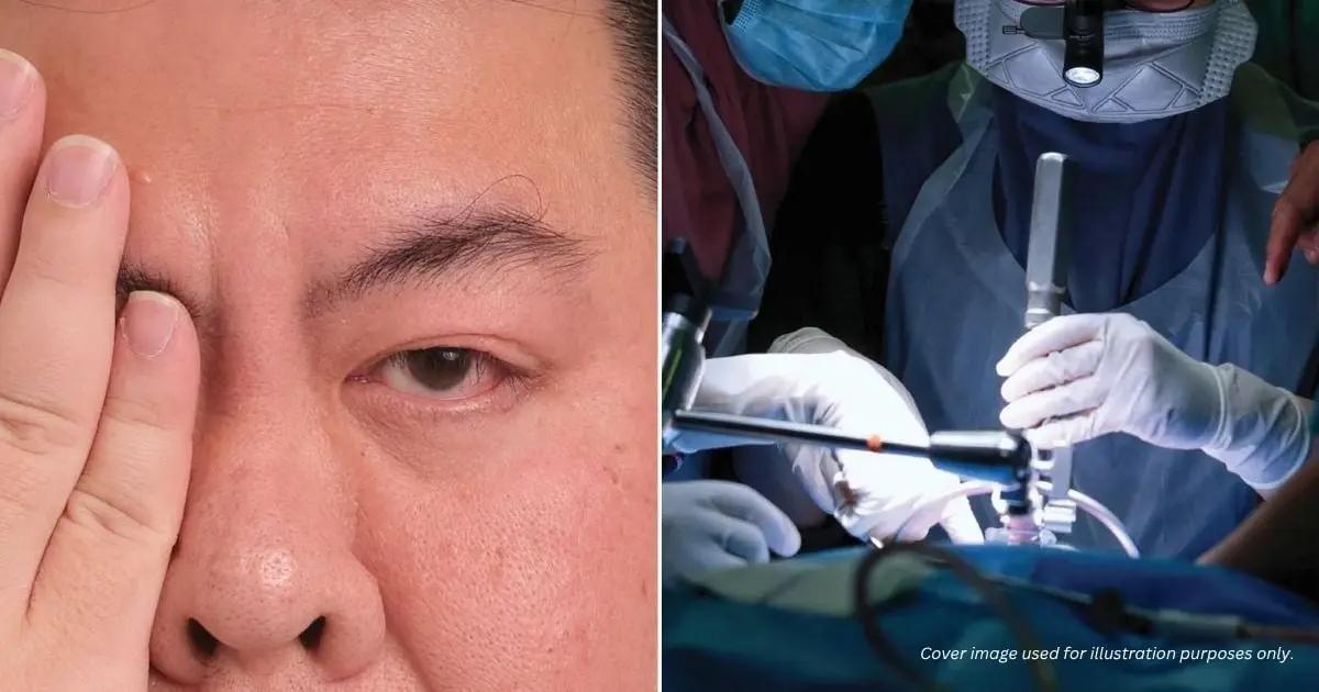 Tin vào mẹo dân gian trên mạng để giải xui khi nháy mắt phải, người đàn ông suýt mù vĩnh viễn vì bị bong võng mạc